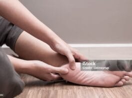 fascitis plantar